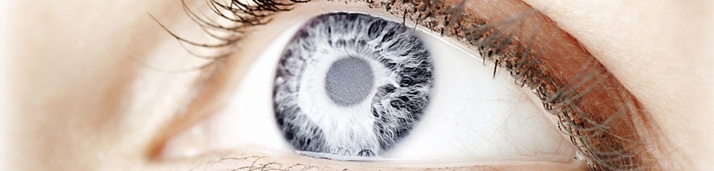 Аспирация врожденной катаракты с имплантацией ИОЛ