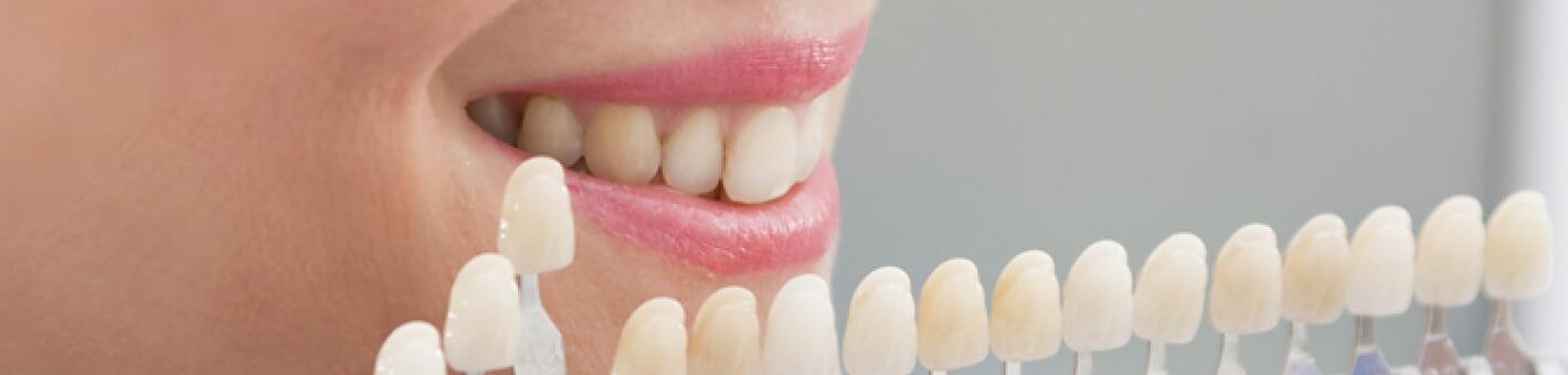 Протезирование коронковой части одного зуба безметалловой коронкой
