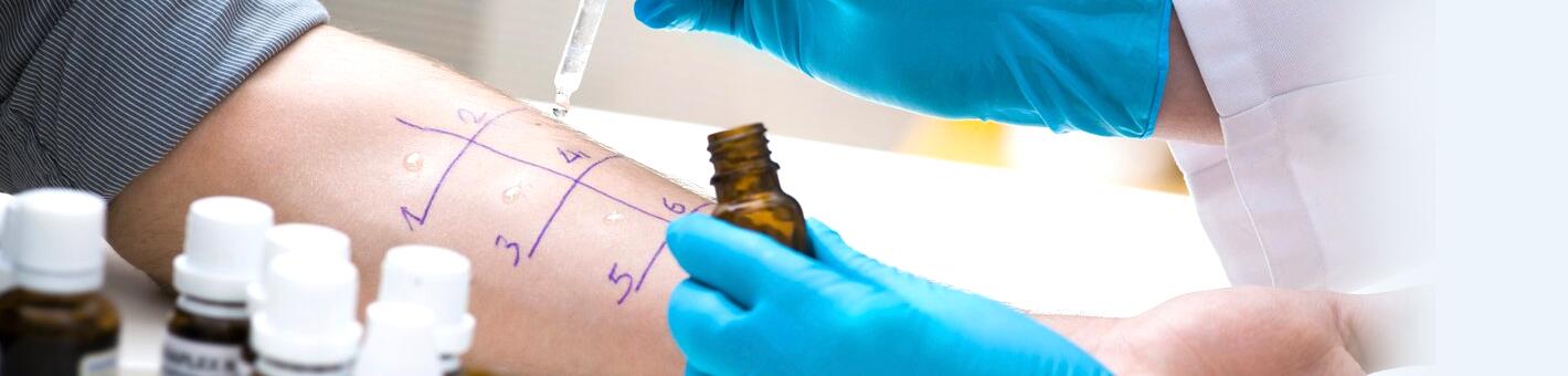 Проведение кожных аллергопроб (скарификационный тест)
