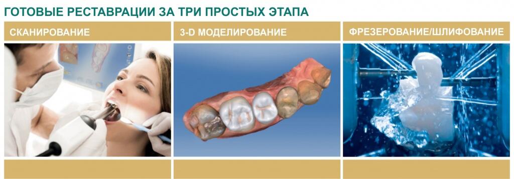 restavratsiya-zubov (1).jpg