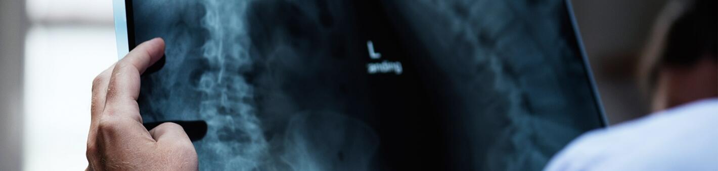 Рентгеновская компьютерная томография костей и суставов (один сустав), мягких тканей в зоне сканирования (без контрастного усиления)  + специальные методы обработки изображений